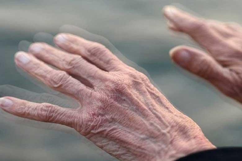عوامل موثر در ابتلا به پارکینسون
